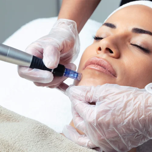 Microneedling con dermapen en barceona